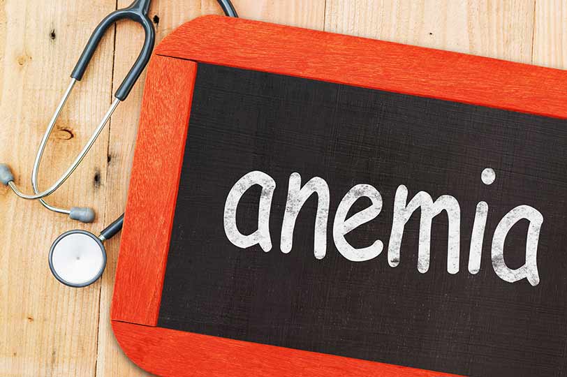 Anemia-treatment-1